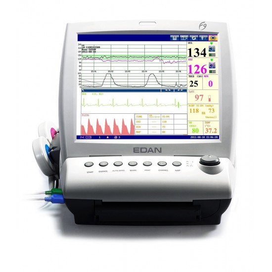 Express Fetal Monitor F9