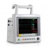IM60 Patient Monitor
