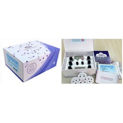Elisa Kit for Insulin (INS) 96 Test