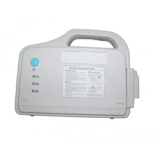 Vein Illuminator 25V