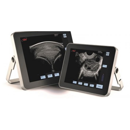 Exapad Mini scanner module kit Exapad Mini scanner module kit