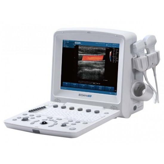 Portable U50 Prime Diagnostic Ultrasound System