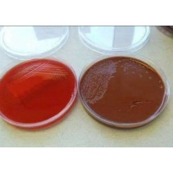 Blood Agar - Chocolate Agar