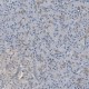 Anti-HSPA6 antibody produced in rabbit , 100 μL