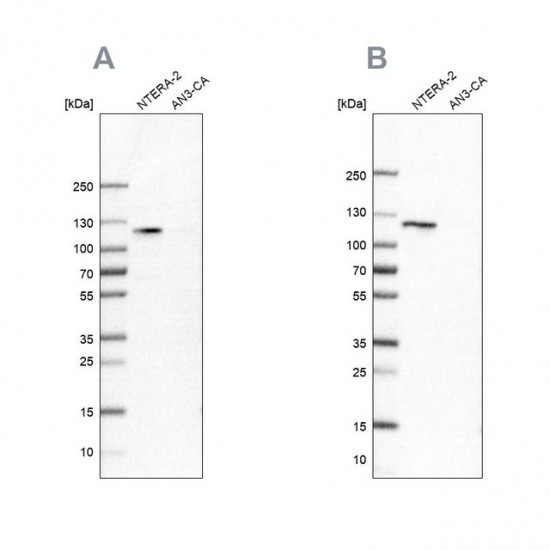 Anti-HSPH1 antibody produced in rabbit , 25 μL