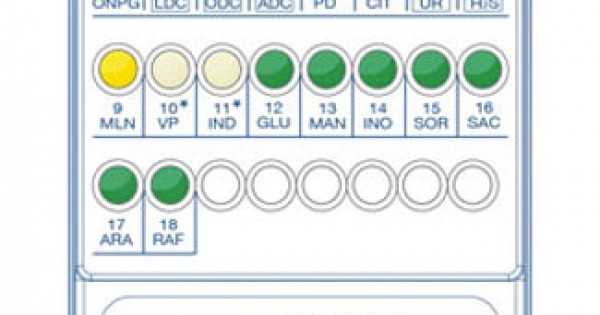 Enterosystem 18 R ( kit +Reagent ) Identification of gram -ve bacteria
