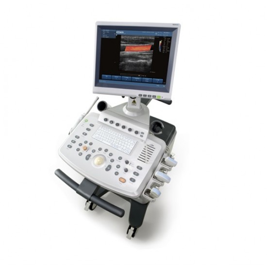Color Doppler Ultrasound U2