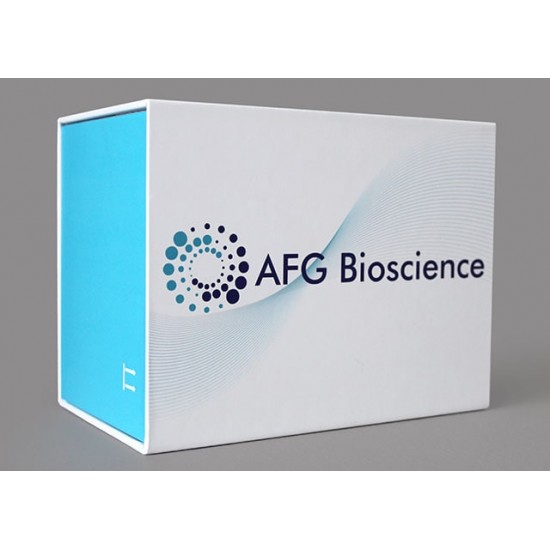 Mouse hepatitis B virus core antibody,HBcAb Elisa Kit, 1x96 well plate