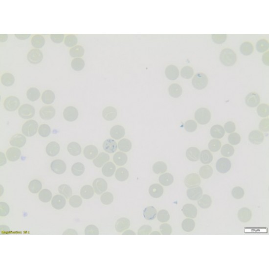 Reticulocyte Stain, 500 ML