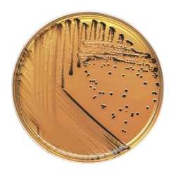 Salmonella Shigella Agar Plat