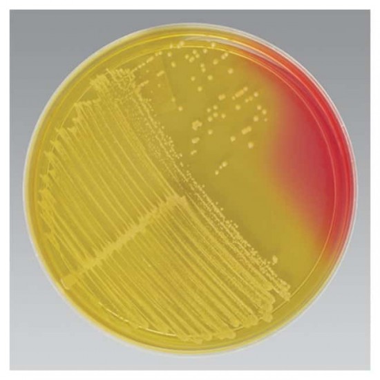 Blood Agar // Mannitol w/Oxacillin