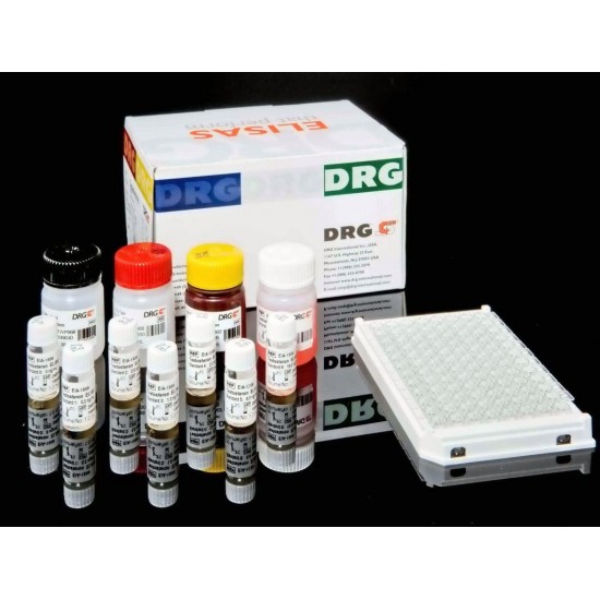 CT-IgA elisa kit Camel Chlamydia Trachomatis IgA (CT-IgA) ELISA Kit CT-IgA elisa kit Camel Chlamydia Trachomatis IgA (CT-IgA) ELISA Kit