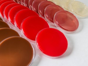 Preparation Of Culture Media