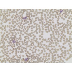 Acid Phosphatase, Leukocyte, (TRAP) Kit