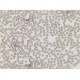Acid Phosphatase, Leukocyte, (TRAP) Kit