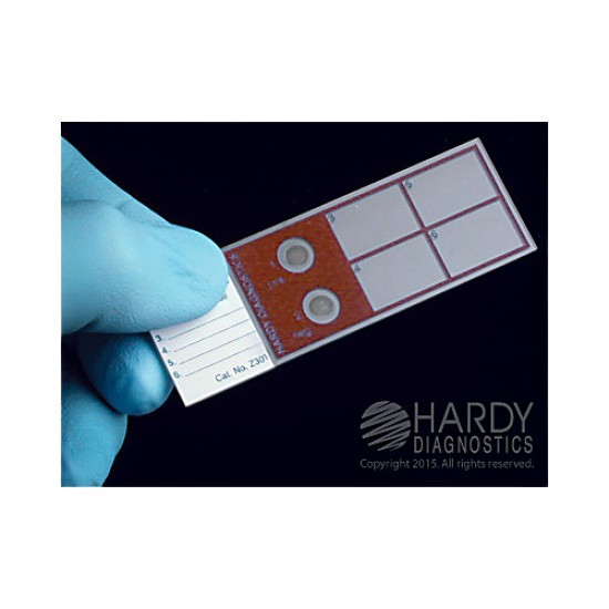 AFB Positive Control (Q-Slide) AFB Positive Control (Q-Slide)