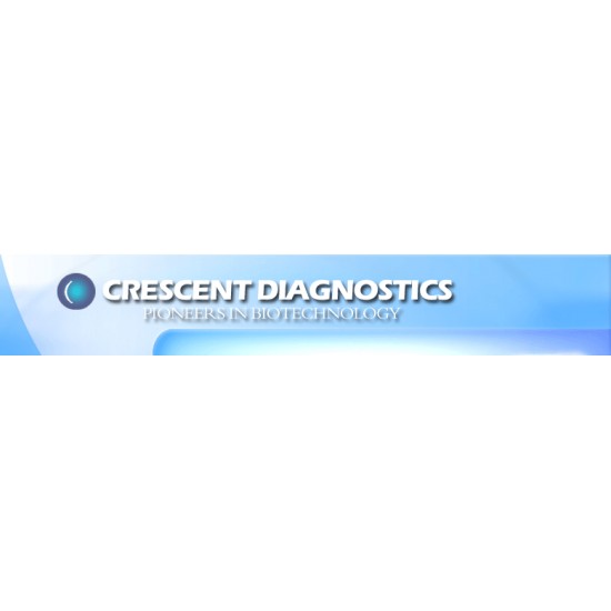 Creatinine (Kinetic) Kit 2x100Ml