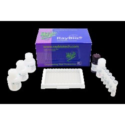 ELISA Kit for Matrix Metalloproteinase 1 (MMP1) Human