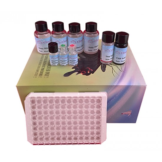 ELISA Kit for Osteopontin ELISA Kit for Osteopontin