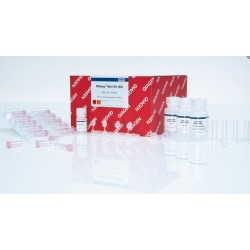 RNeasy Mini Kit (250) RNeasy Mini Kit (250)