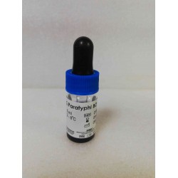Salmonella Paratyphi-BO/ 5ml Salmonella Paratyphi-BO/ 5ml